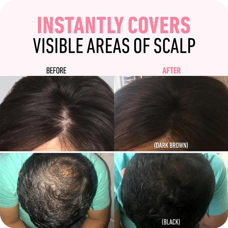 💗Hairline Powder - Magic Root Cover Up (fit all hair color)